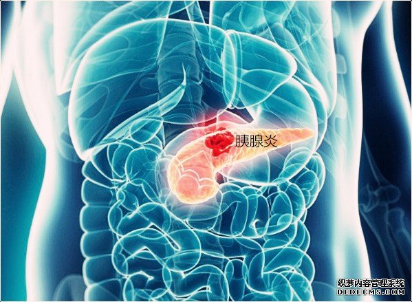 1511795504853136.jpg ercp-endoscopy-procedure_副本.jpg