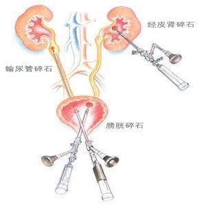 1515490530950845.jpg 1515490530950845.jpg