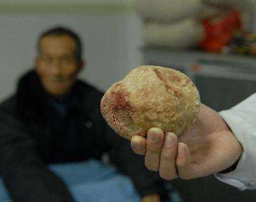 1515490569255689.jpg 1515490569255689.jpg