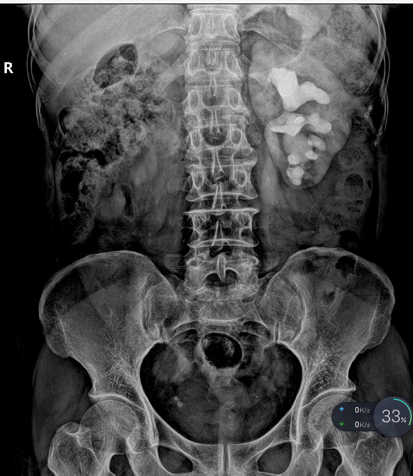 1515490270883567.png 1515490270883567.png