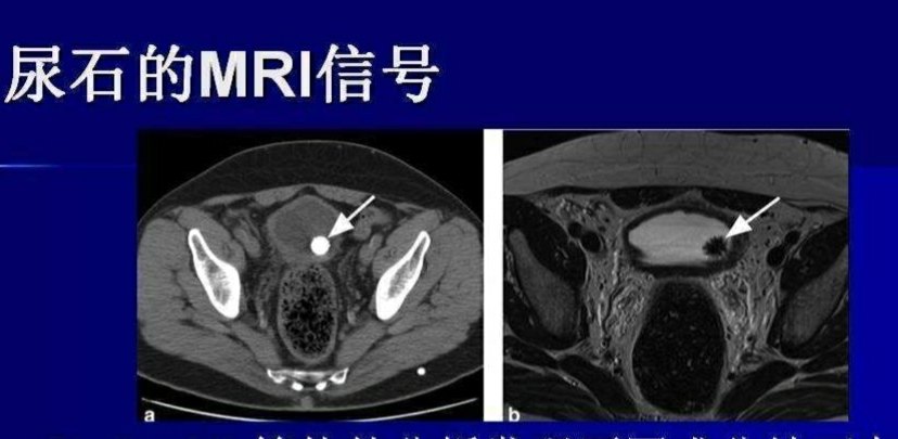 1515490303405909.jpg 1515490303405909.jpg