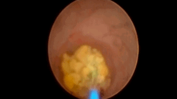 1519643818810064.gif 1519643818810064.gif