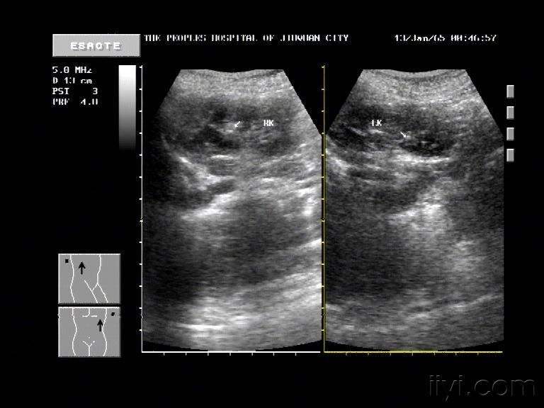 1515490218746133.jpg 1515490218746133.jpg