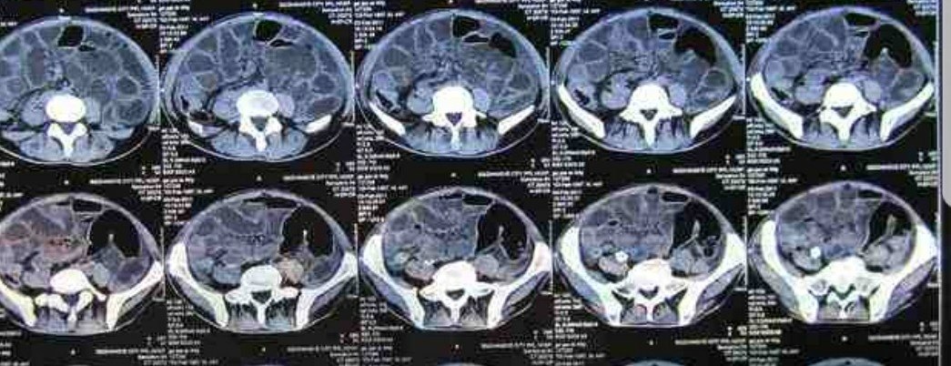 1515490293224661.jpg 1515490293224661.jpg